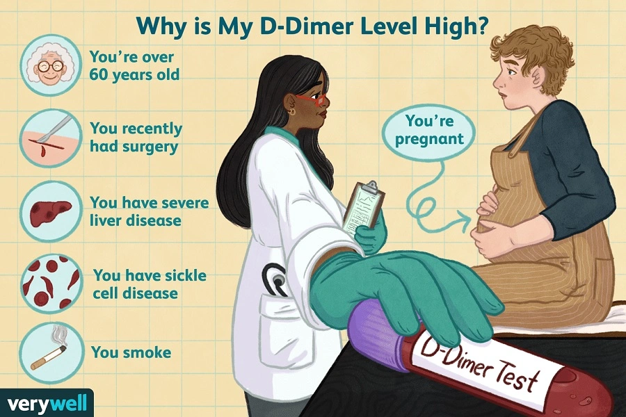 What Level of D-Dimer Is Dangerous
